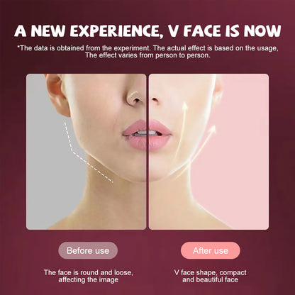 Microcurrent EMS Face Massager - LED Photon Therapy